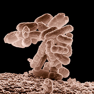 e-coli bacteria (coliform bacteria)